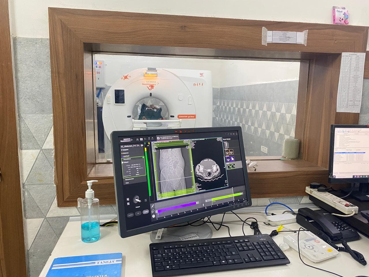 Cardiology & Cardiac Care at Prime Hospital Ramgarh